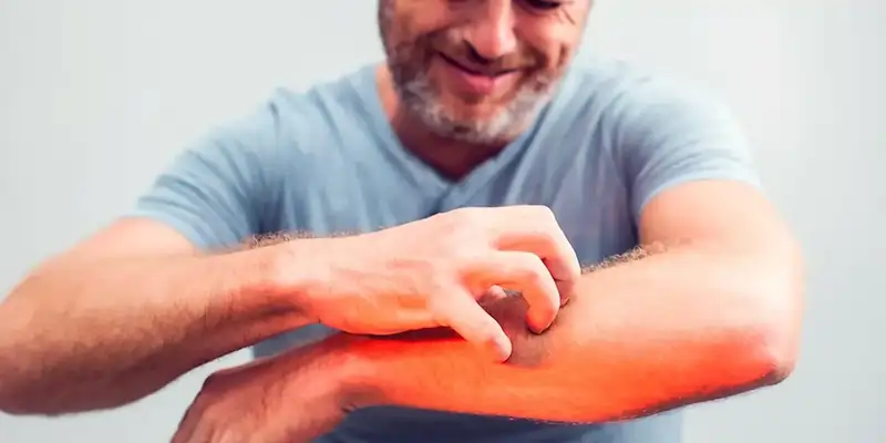 Qaşınmaya qarşı nə etməli ❓Qaşınmanın müalicəsi✅