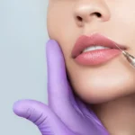 ESTETİK və Kosmetoloji prosedurlar